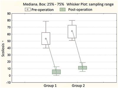 A Comparative Study of Surgical Correction of Idiopathic Scoliosis With Spinal Transpedicular Metal Structures in Children